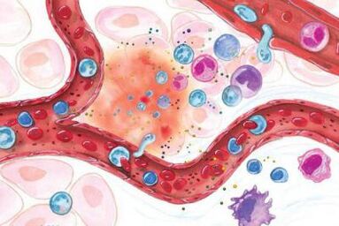 Επίδραση του Boswellia σε φλεγμονώδεις περιοχές του σώματος